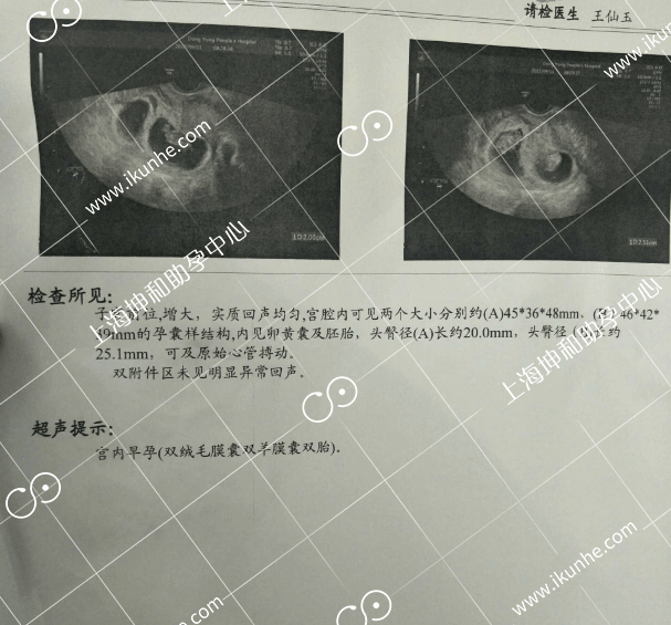 弱精试管婴儿坤和一次好孕